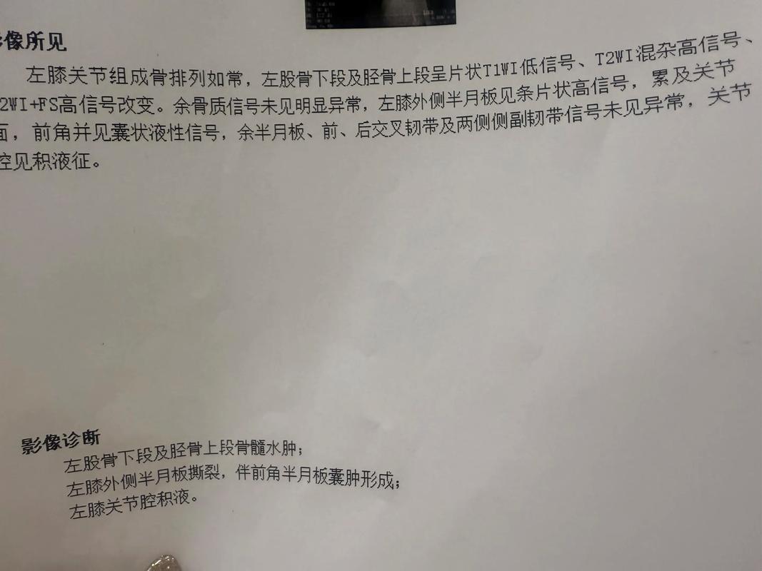 TA：加维伤势原本判断为半月板挫伤，手术检查时才发现是断裂