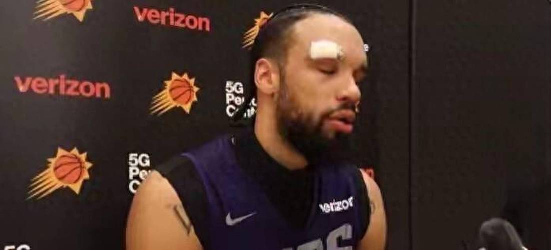 明日对阵灰熊!太阳官方:杰伦-格林出战成疑 狄龙缺席