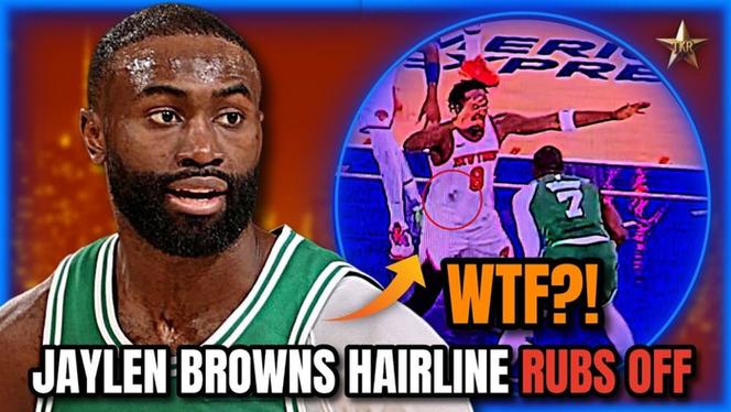 茂密头顶不是梦!多家植发机构联系杰伦-布朗!